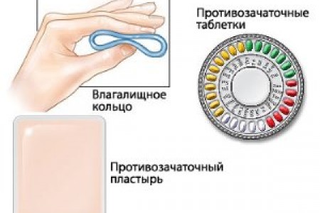 Виды гормональных контрацептивов